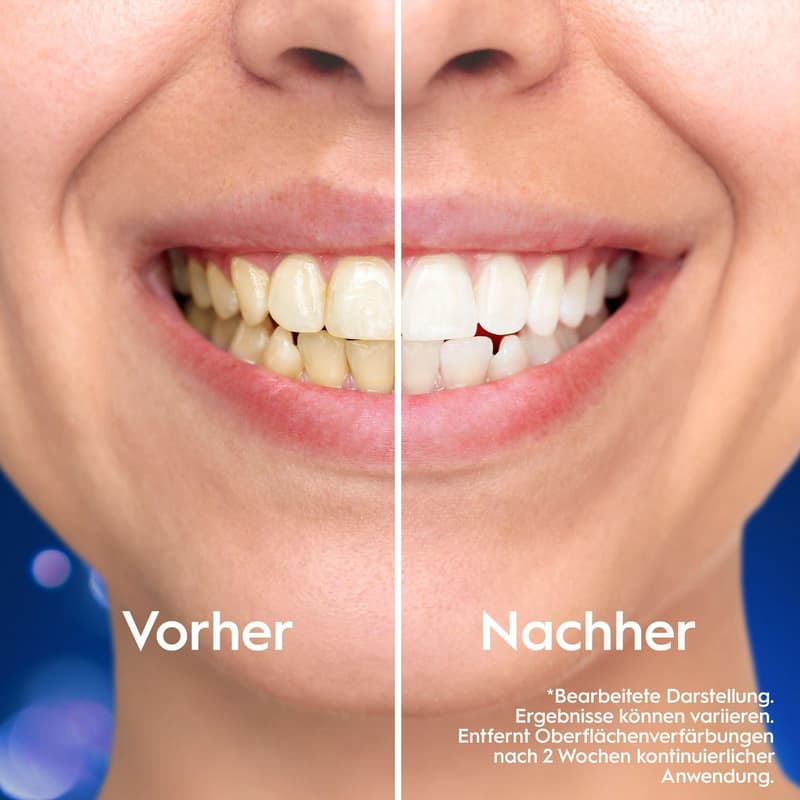 Oral-B Pro 3D White Clinical Intensive Whitening Zahnpasta, Kühle Minze