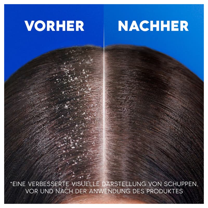 Head & Shoulders Citrus Fresh Anti-Dandruff Shampoo Oily Hair